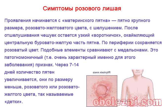 Отрубевидный (разноцветный) лишай: ление, препараты, мази