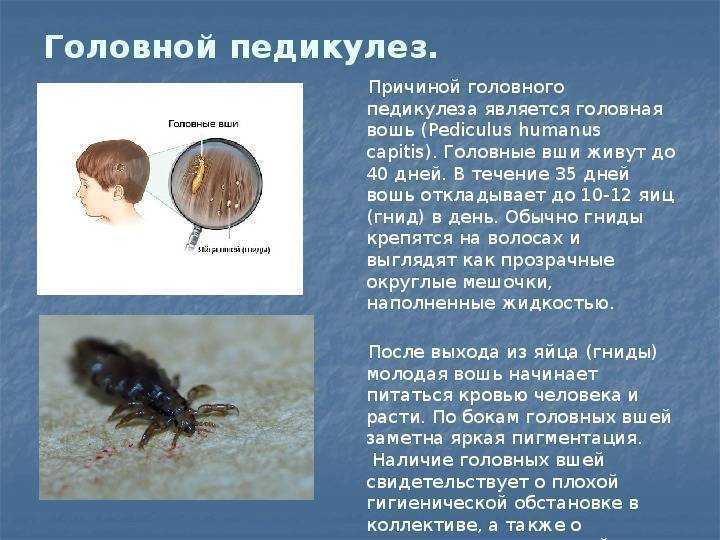 Эктопаразитарные инфекции: фтириаз | университетская клиника