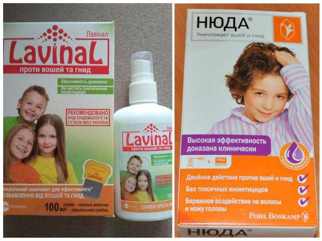 Как избавиться от вшей и гнид - различные методы борьбы с педикулезом