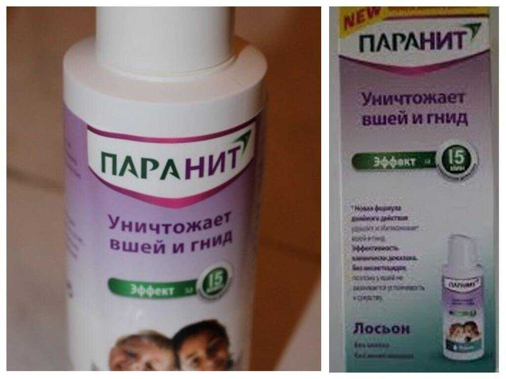 Лечение и профилактика педикулеза у детей