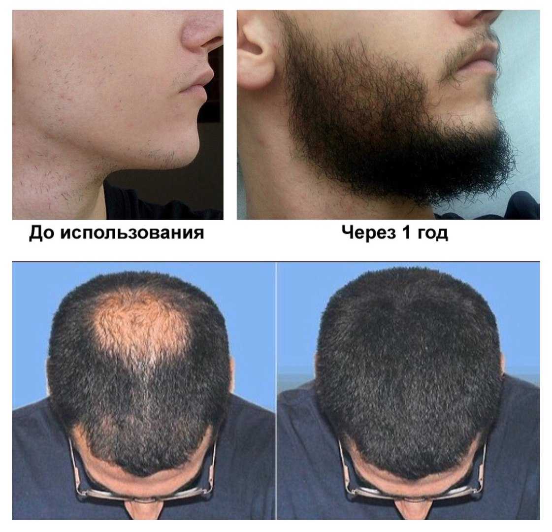 Как бороться с сединой и победить – 26 лучших способов и средств в решении проблемы