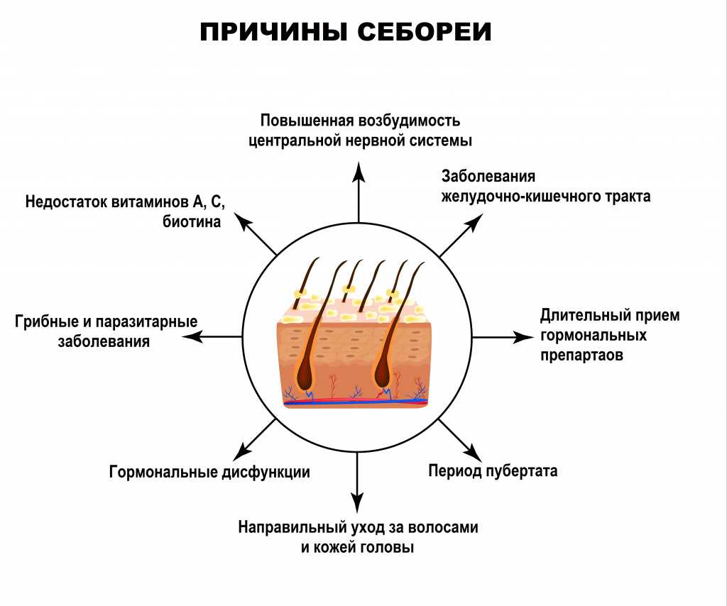 Все про жирные волосы: гид ath с разбором причин, лучшими средствами и домашними рецептами