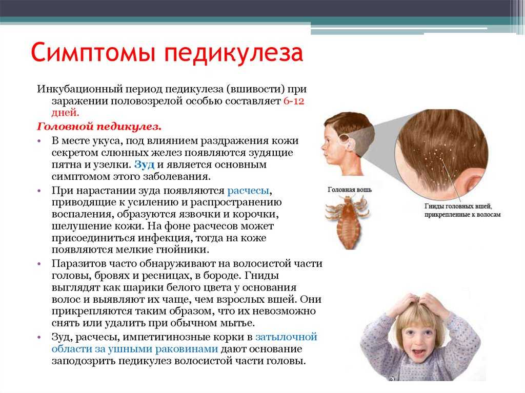 Отличия между перхотью и вшами: признаки педикулёза