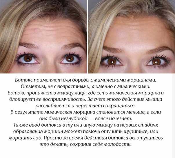 Ботокс для волос: мыть ли голову перед ним, а также когда можно будет это сделать после процедуры и чем нужно пользоваться?