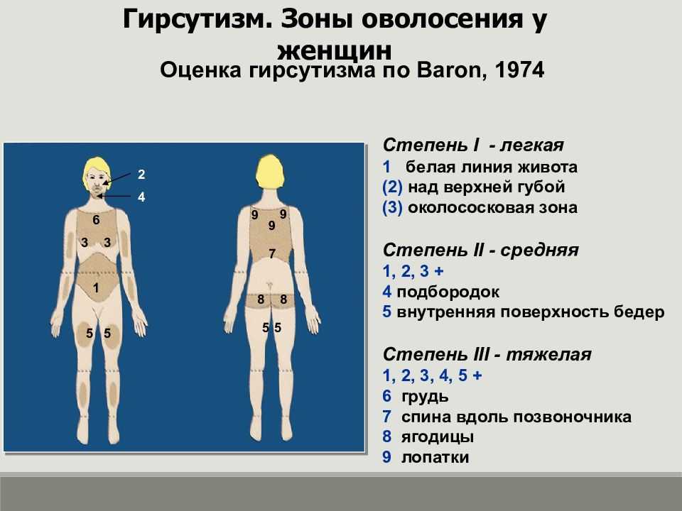 Волосы на лице у женщин | медицинский портал eurolab