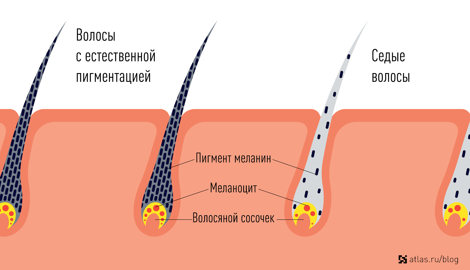 Ученые выяснили связь ранней седины и стресса | университетская клиника