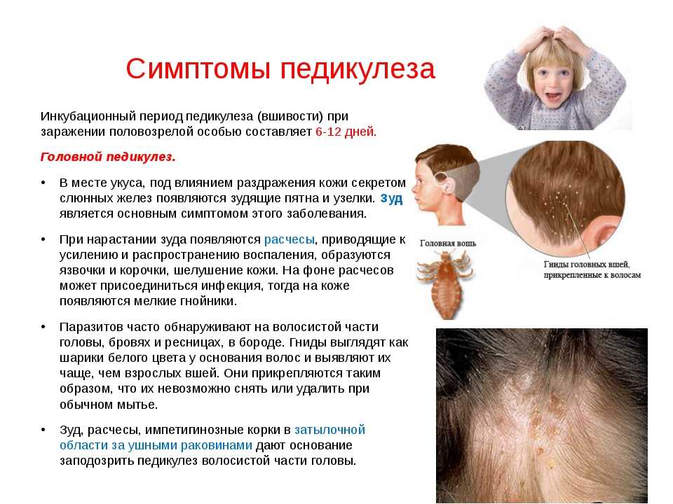 Пиодермия: типы, диагностика, лечение, препараты