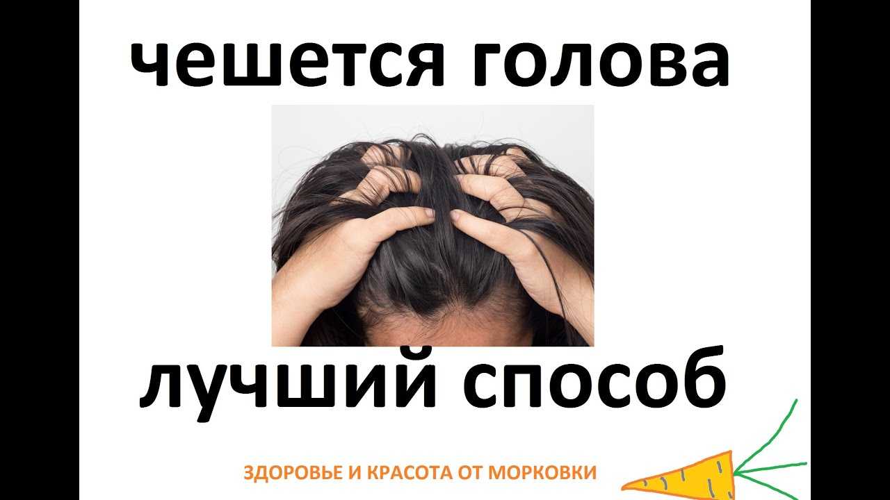 Причины возникновения перхоти на голове у мужчин и женщин