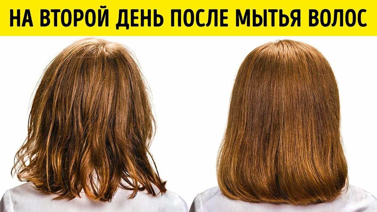 Лечение жирных волос - причины и средства лечения жирных волос
