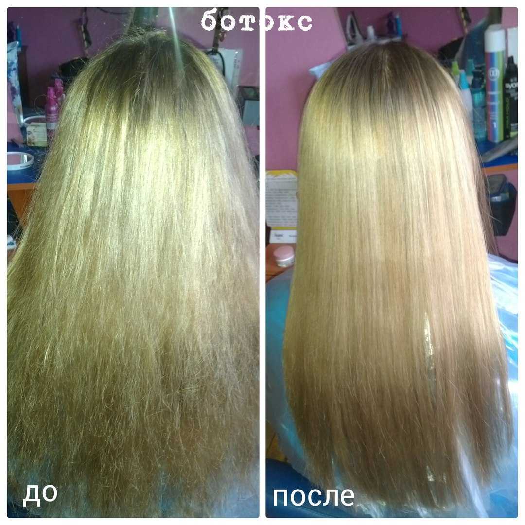 Ботокс и ламинирование: плюсы и минусы каждой процедуры