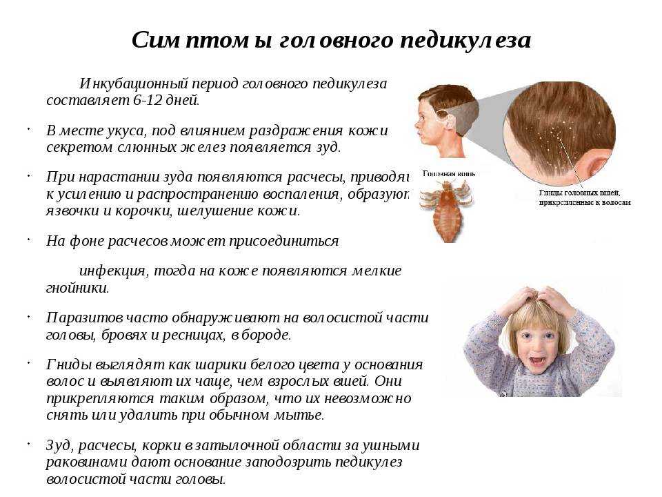 Как отличить перхоть от вшей — проверенные способы | паранит