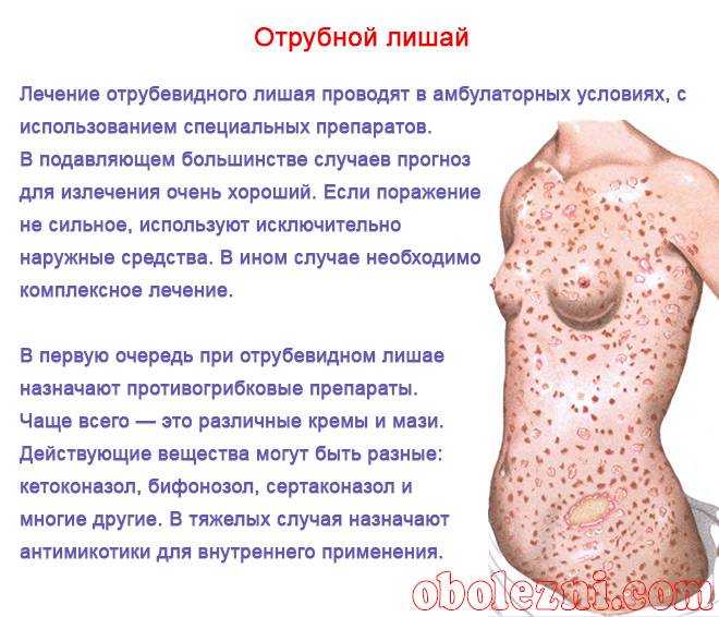 Болезнь девержи: фото, лечение, причины и симптомы
