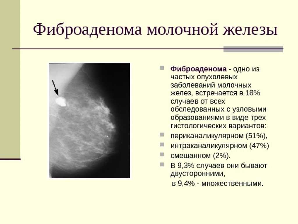 Лопух для волос: все секреты для пышной и густой шевелюры